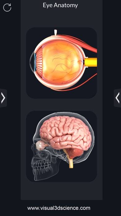 My Eye Anatomy Скриншот приложения #2