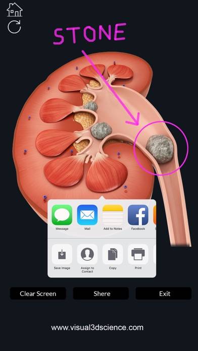 My Kidney Anatomy App screenshot #6