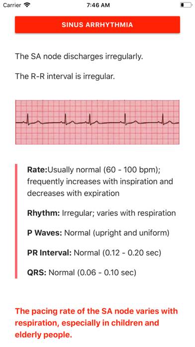 ECG FlashCards Pro