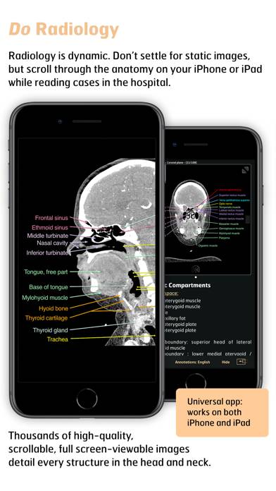 Radiology Schermata dell'app #3