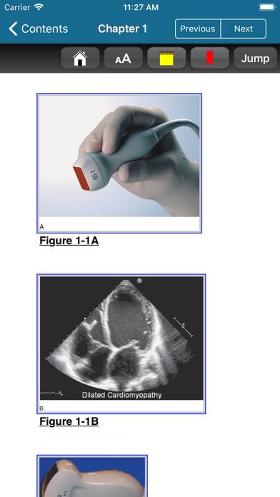 Atlas Emergency Ultrasound, 2E Captura de pantalla de la aplicación