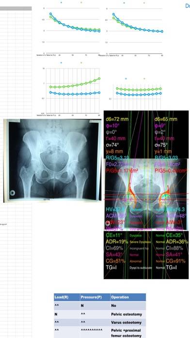 HipDysplasiaPro App-Screenshot