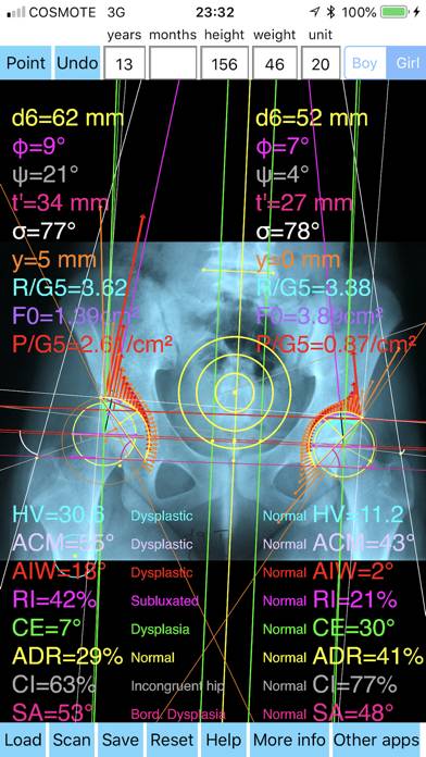 HipDysplasiaPro App-Screenshot
