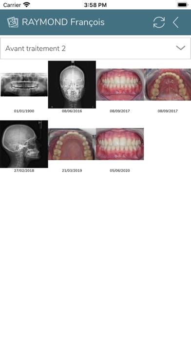 Dental Photos Capture d'écran de l'application #3