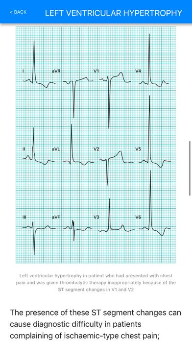 ECG Basics Pro App screenshot #3