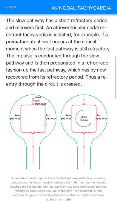 ECG Basics Pro App screenshot #4