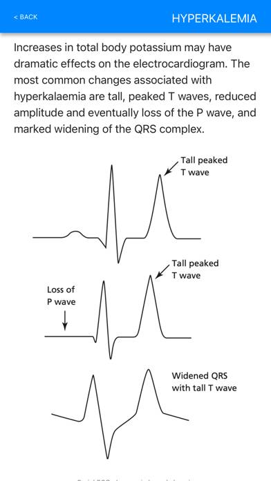 ECG Basics Pro App screenshot #6