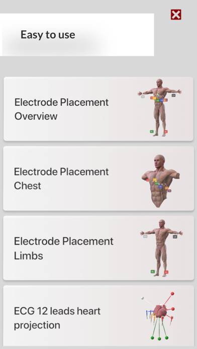3D ECG Leads immagine dello schermo