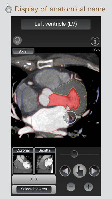 CT Passport Heart / MRI immagine dello schermo
