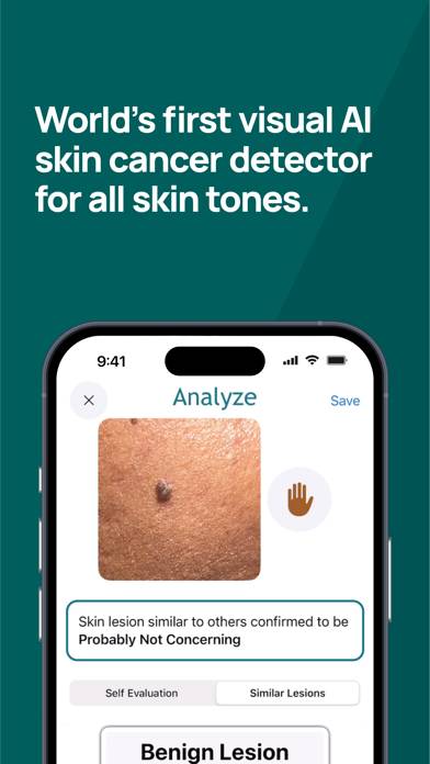 Skin-Check Captura de pantalla de la aplicación #2