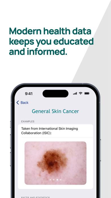 Skin-Check Captura de pantalla de la aplicación #5