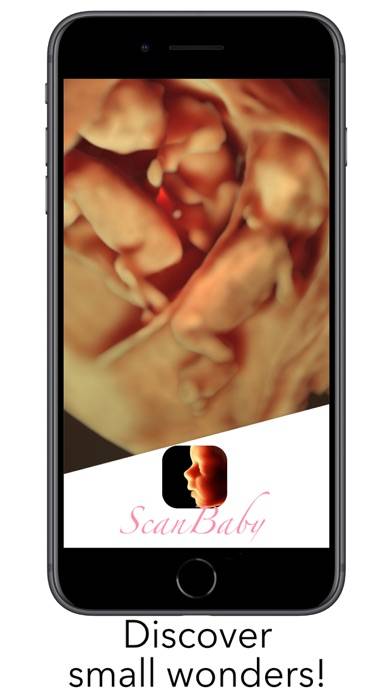 ScanBaby learn baby ultrasound immagine dello schermo