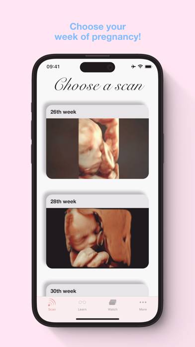 ScanBaby learn baby ultrasound Capture d'écran de l'application #2
