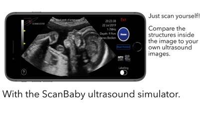 ScanBaby learn baby ultrasound Uygulama ekran görüntüsü #3