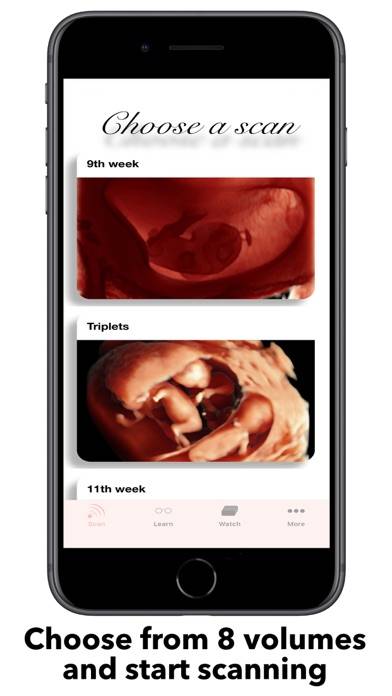 ScanBaby learn baby ultrasound Uygulama ekran görüntüsü #4