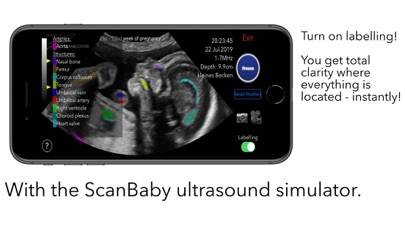 ScanBaby learn baby ultrasound Uygulama ekran görüntüsü #6