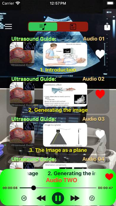 Ultrasound Guide Case Studies Captura de pantalla de la aplicación