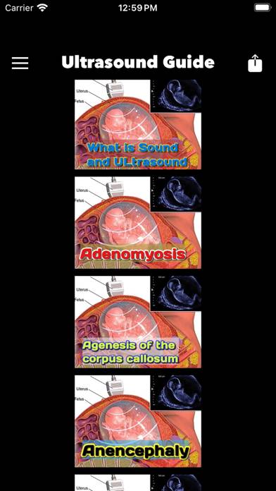 Ultrasound Guide Case Studies Captura de pantalla de la aplicación
