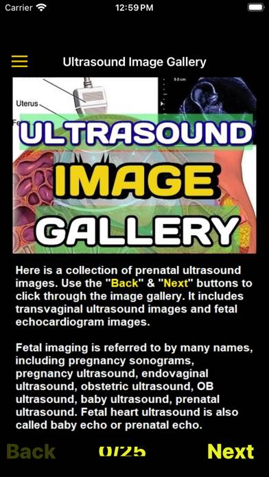Ultrasound Guide Case Studies Captura de pantalla de la aplicación
