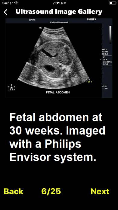 Ultrasound Guide Case Studies Captura de pantalla de la aplicación