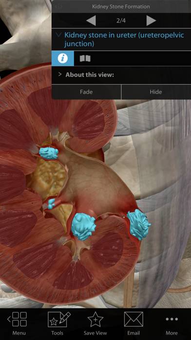 Physiology & Pathology Capture d'écran de l'application #4