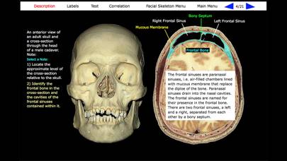 Human Skeleton: Gross Anatomy App screenshot #1