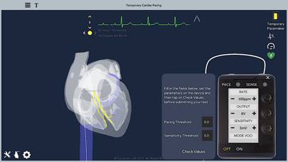 Temporary Cardiac Pacing App screenshot #5