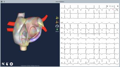 Atrial Fibrillation App screenshot