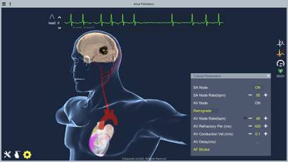 Atrial Fibrillation App screenshot