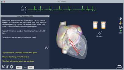 Atrial Fibrillation App screenshot