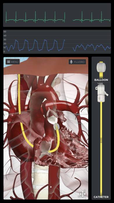 Mentice Right Heart Cath App-Screenshot #2