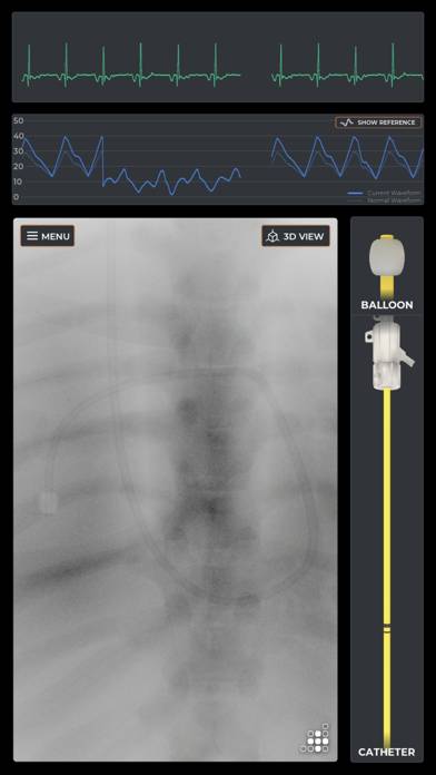Mentice Right Heart Cath App-Screenshot #3