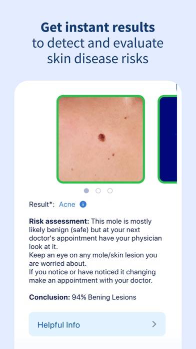 AI Dermatologist: Skin Scanner App screenshot #4