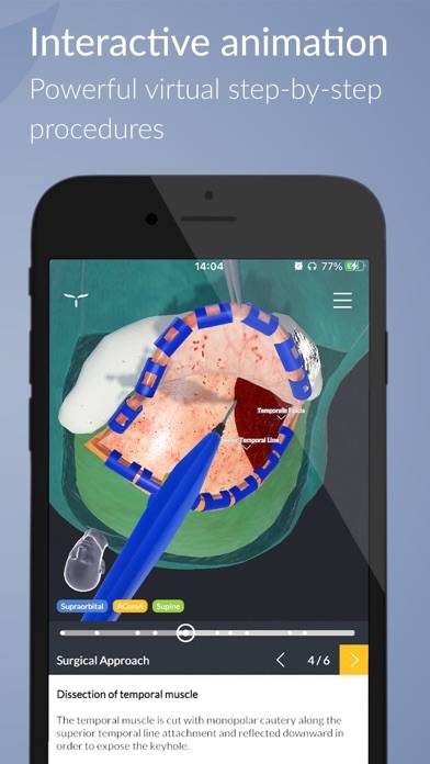 UpSurgeOn Neurosurgery Schermata dell'app