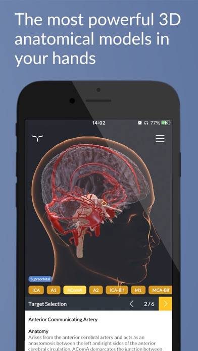 UpSurgeOn Neurosurgery Schermata dell'app