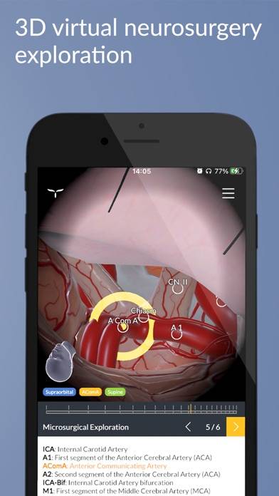 UpSurgeOn Neurosurgery Schermata dell'app