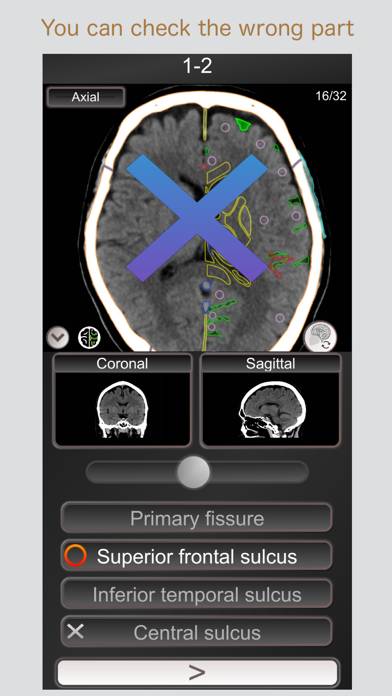 CT PassQuiz Head/Brain / MRI App skärmdump #2
