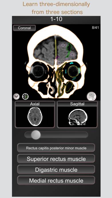 CT PassQuiz Head/Brain / MRI App screenshot #3