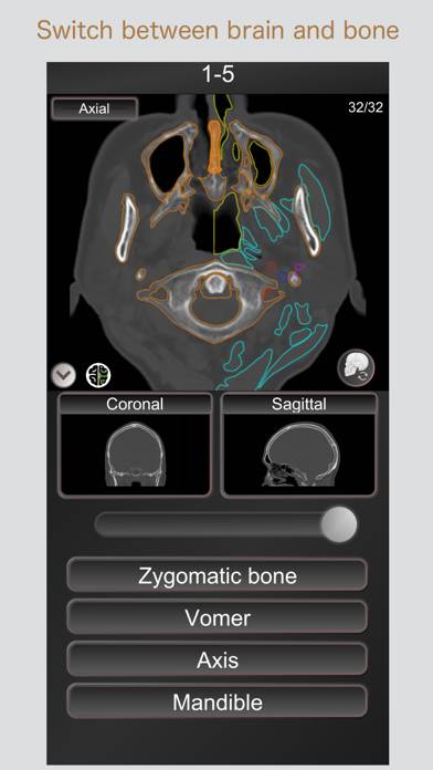 CT PassQuiz Head/Brain / MRI App screenshot #4