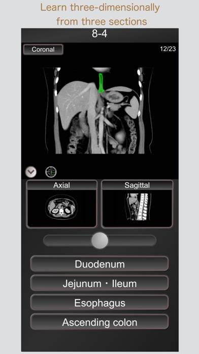 CT PassQuiz Abdomen / MRI Schermata dell'app #3