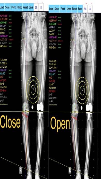 OsteotomyApp Capture d'écran de l'application #6