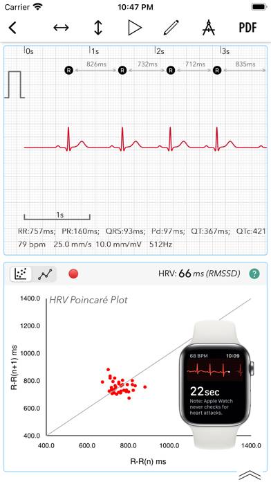 ECG plus | Analyzer for QTc & HRV Capture d'écran de l'application #1