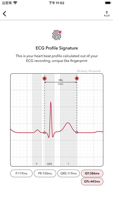 ECG plus | Analyzer for QTc & HRV Capture d'écran de l'application #3