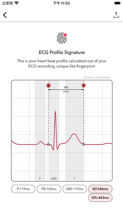 ECG plus | Analyseur pour QTc HRV Capture d'écran de l'application #3