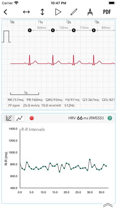 ECG plus | Analyzer for QTc & HRV Schermata dell'app #5