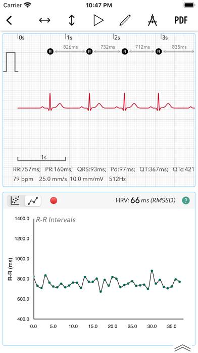 ECG plus | Analyseur pour QTc HRV Capture d'écran de l'application #5