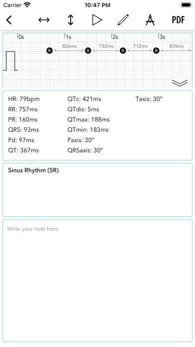 ECG plus | Analyzer for QTc & HRV App-Screenshot #6