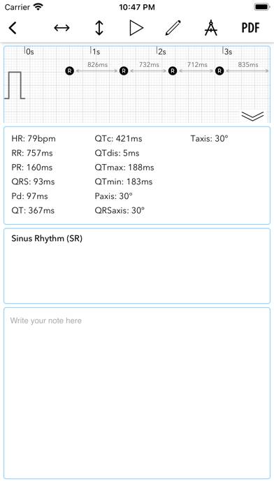 ECG plus | Analyseur pour QTc HRV Capture d'écran de l'application #6