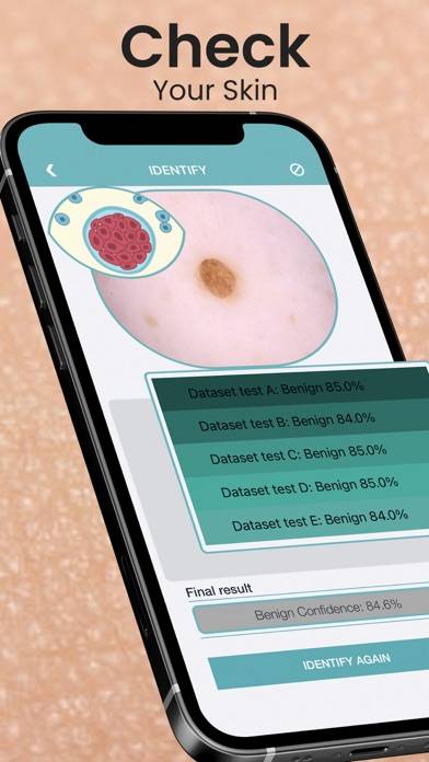 Mole Checker Skin Dermatology Capture d'écran de l'application #1