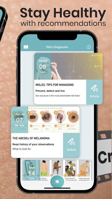 Mole Checker Skin Dermatology Capture d'écran de l'application #3